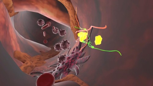 Colon VR-Prevention Lab: in Lombardia la realtà v...
